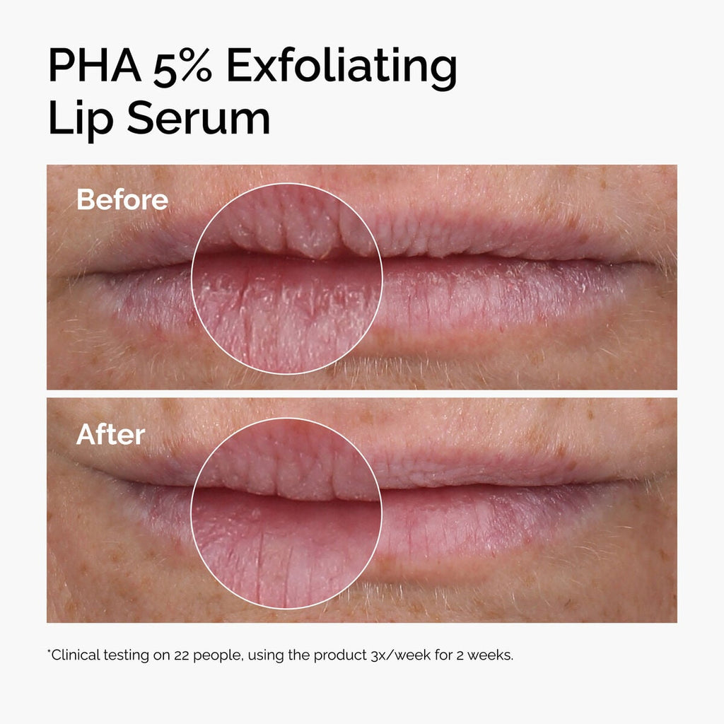 PHA 5% Exfoliating Lip Serum Targeted Serum Care